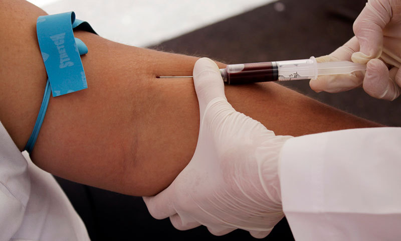 First-of-its-kind analysis of trend data from 188 countries shows the deadly disease is claiming more lives in Pakistan than ever.—Reuters/File photo