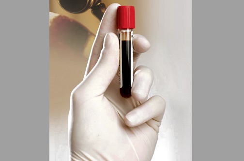 Blood tested for HIV/AIDS